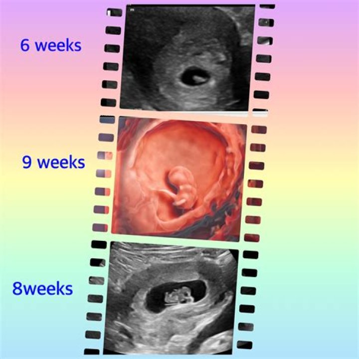 Can you get scanned at 7 weeks pregnant?