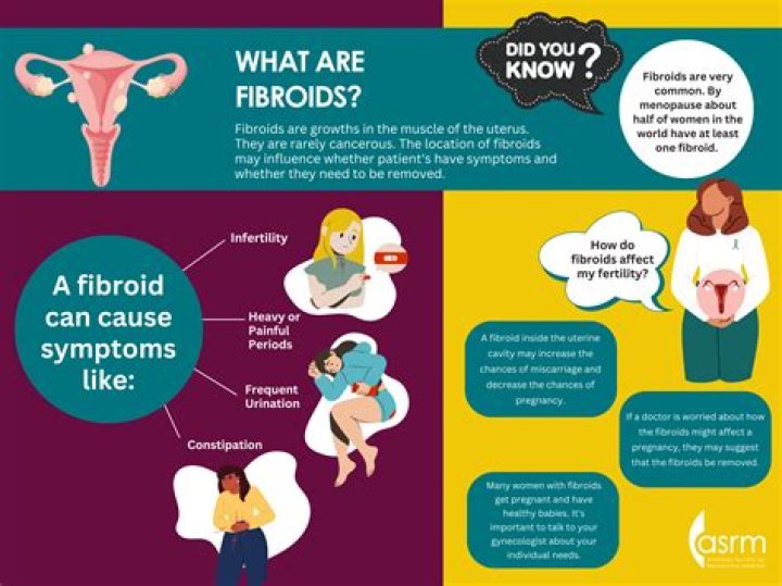How do you treat Subserosal fibroids?